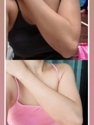 Tomato-Gluta-Collagen-Feedback_Box-1-₹1700_-Thla-1-ei_🛵Free-Delivery___Tlawm-si-tha-si-mitin-ei-phak-turJPG_1-r6ry52asxwyybzucky61yxxk4h4cqu42v8vfv5b8v4